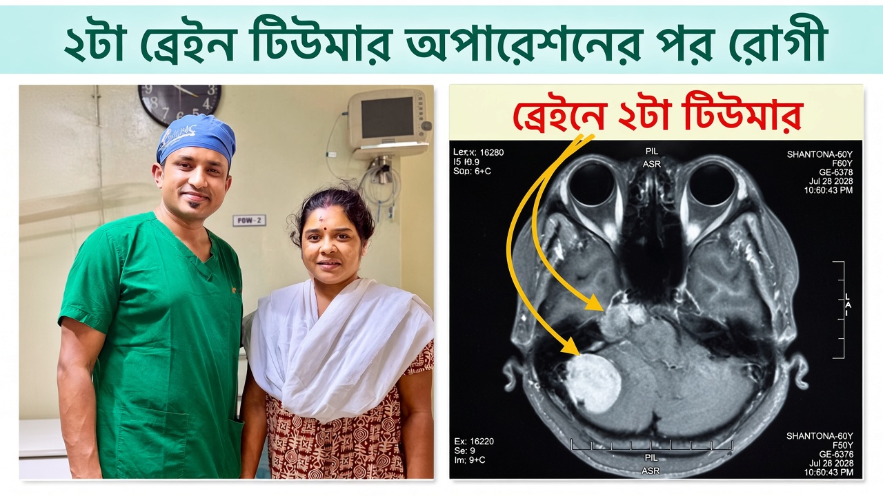 Microscopic Brain Tumor Surgery